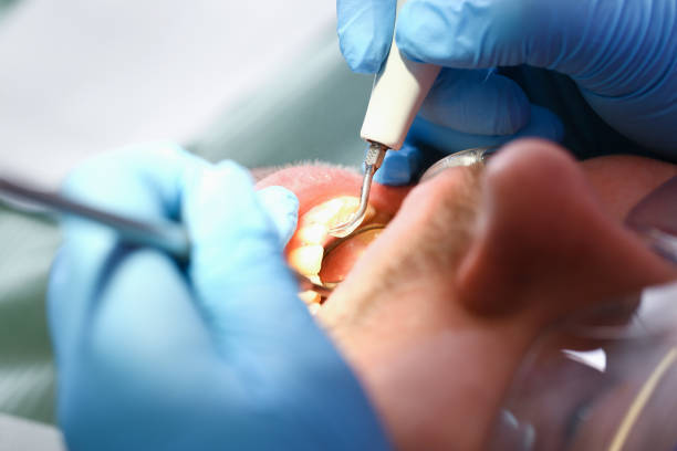 Best Knocked-Out Tooth Emergency  in Waldorf, MD