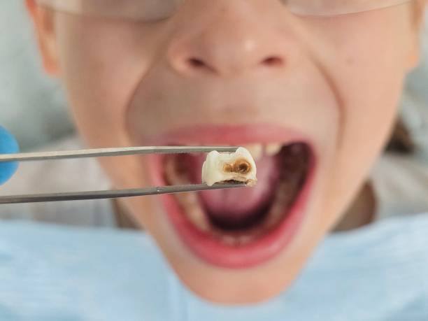 Emergency Dentist Open Today in MD