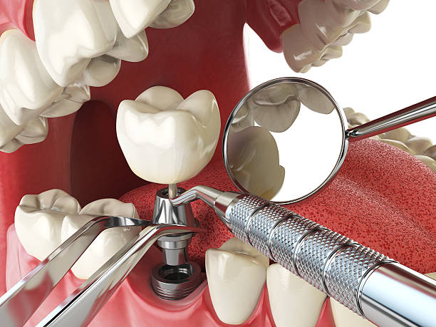 Best Emergency Gum Pain Relief  in Waldorf, MD